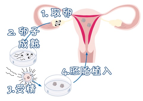 关于丹韵生殖